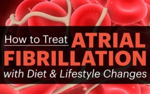 afib treatments, afib