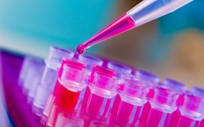 How is Multiple Myeloma Diagnosed?