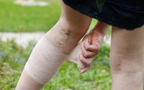 Ways To Prevent Deep Vein Thrombosis