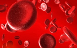 The Main Causes of Deep Vein Thrombosis