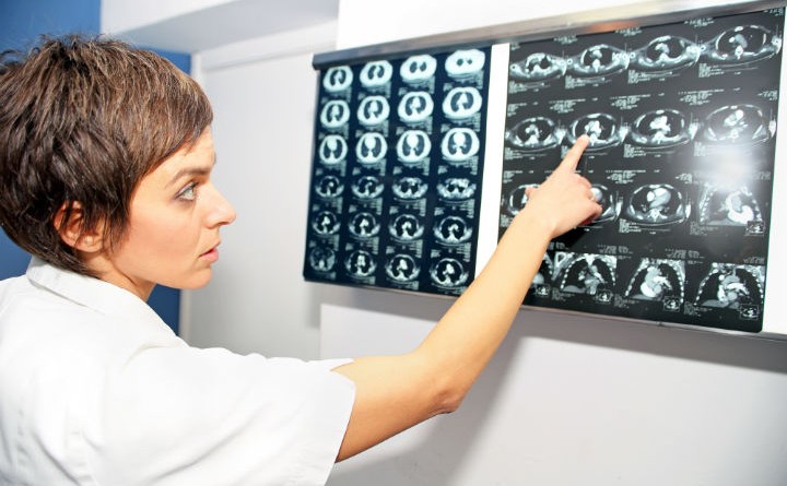 treatment pulmonary embolism, pulmonary embolism treatment, pulmonary embolism treatments, treatments for pulmonary embolism, treatment for pulmonary embolism, pulmonary embolism info